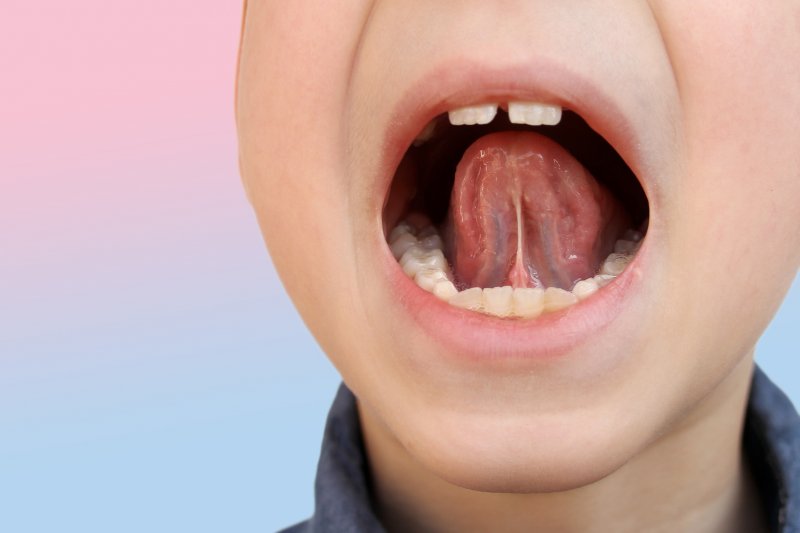 an up-close look at a child’s tongue tie